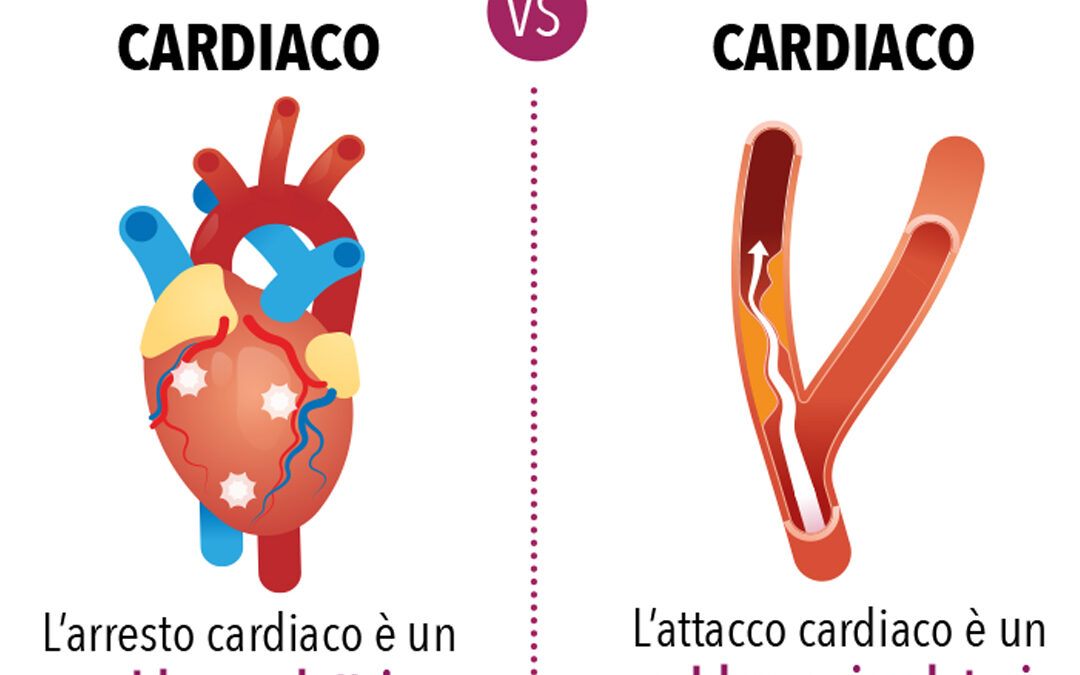 Qual è la differenza tra arresto cardiaco e attacco cardiaco?